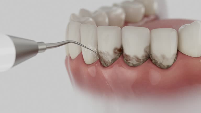 Trusted Invisalign Clear Aligners service in Owings, MD - Dentist Open Now